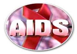 HIV
