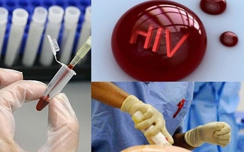 Phương pháp tiếp cận khác biệt hứa hẹn loại bỏ hoàn toàn virus HIV
