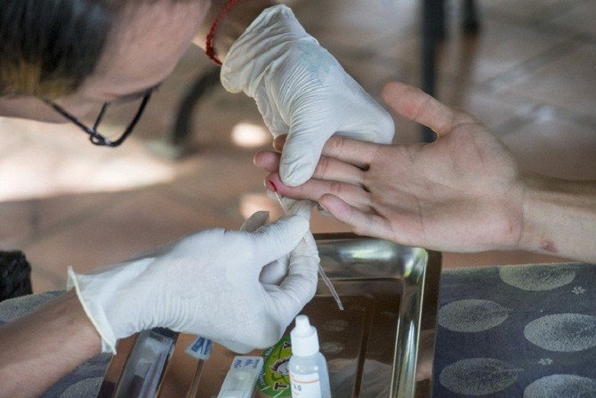 Nguyên tắc tư vấn, xét nghiệm HIV tại cộng đồng
